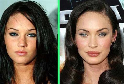 megan fox boobjob|Megan Fox Details Plastic Surgeries Including Multiple Breast .